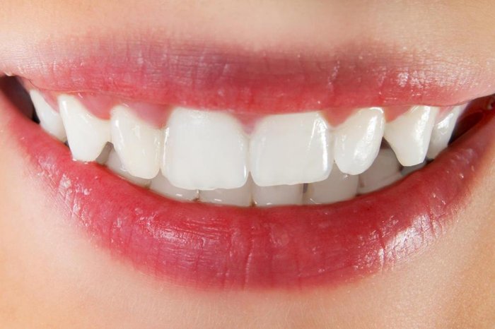 White healthy teeth of smiling woman White healthy teeth of smiling woman