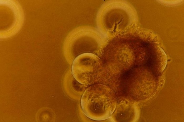 Dr. Jeanne Becker / NASA Spinoff Dr. Jeanne Becker / NASA Spinoff