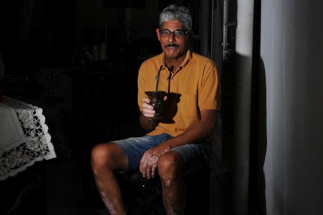  Santa Maria 10/09/2017Estresse pode ser um fator desencadeante do Vitiligo Case &iquest; Porf&iacute;rio Soares Ign&aacute;cio &iquest; 76 anos &iquest; aposentado Esposa dele &iquest; Rosa Bento 72 anos &iquest; costureira