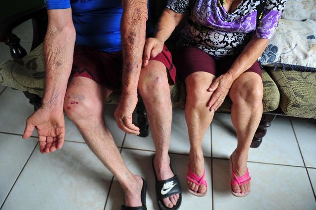 JOINVILLE,SC,BRASIL,20-12-2017.Idoso Agredido no Trãnsito.Senhor idoso é agredido no trânsito,Valdir Manoel Tomaz junto de sua esposa Landir Pareira Tomaz.(Foto:Salmo Duarte/A Notícia) JOINVILLE,SC,BRASIL,20-12-2017.Idoso Agredido no Trãnsito.Senhor idoso é agredido no trânsito,Valdir Manoel Tomaz junto de sua esposa Landir Pareira Tomaz.(Foto:Salmo Duarte/A Notícia)
