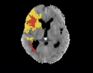 Reprodução Reprodução