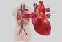 Cateterismo e angioplastia no combate a problemas cardíacos