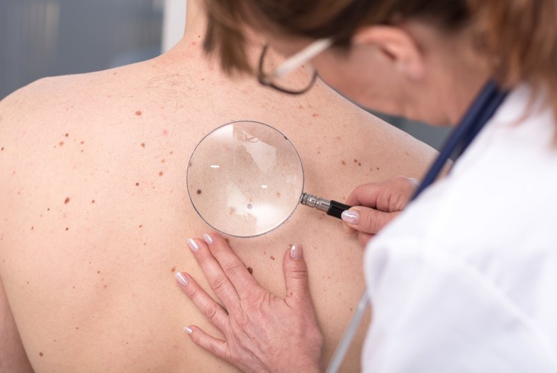 Médica examina paciente com suspeita de câncer de pele