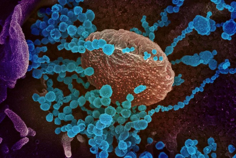  This handout illustration image obtained February 27, 2020 courtesy of the National Institutes of Health taken with a scanning electron microscope  shows SARS-CoV-2 (round blue objects) emerging from the surface of cells cultured in the lab, SARS-CoV-2, also known as 2019-nCoV, is the virus that causes COVID-19, the virus shown was isolated from a patient in the US. - President Donald Trump has played down fears of a major coronavirus outbreak in the United States, even as infections ricochet around the world, prompting a ban on pilgrims to Saudi Arabia. China is no longer the only breeding ground for the deadly virus as countries fret over possible contagion coming from other hotbeds of infection, including Iran, South Korea and Italy. There are now more daily cases being recorded outside China than inside the country, where the virus first emerged in December, according to the World Health Organization. (Photo by Handout / National Institutes of Health / AFP) / RESTRICTED TO EDITORIAL USE - MANDATORY CREDIT AFP PHOTO /NATIONAL INSTITUTES OF HEALTH/NIAID-RML/HANDOUT  - NO MARKETING - NO ADVERTISING CAMPAIGNS - DISTRIBUTED AS A SERVICE TO CLIENTSEditoria: HTHLocal: WashingtonIndexador: HANDOUTSecao: healthcare policyFonte: National Institutes of HealthFotógrafo: Handout<!-- NICAID(14435480) -->