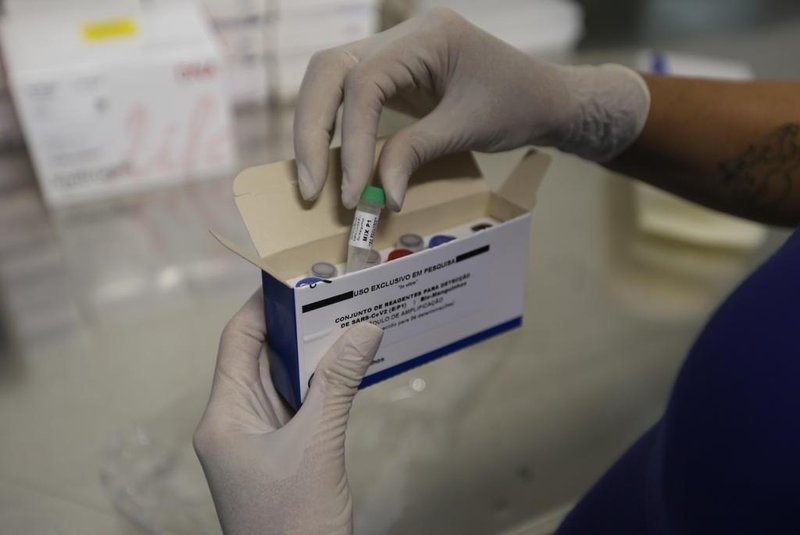 PORTO ALEGRE, RS, BRASIL, 09/03/2020- Exames Coronavirus.Equipe do Laboratório Central de Saúde Pública do Rio Grande do Sul (Lacen). Funcionamento dos kit para testes do coronavírus.(FOTOGRAFO: LAURO ALVES / AGENCIA RBS)<!-- NICAID(14445453) -->