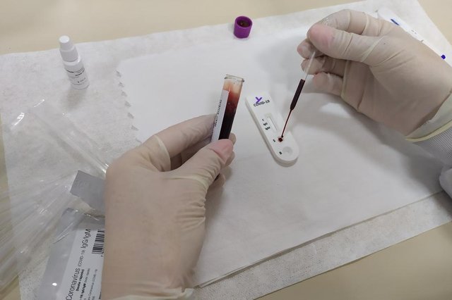 Doações aos hospitais da região se reverteram em proteção e estrutura. Na foto, os testes no Hospital Tacchini, de Bento<!-- NICAID(14506497) --> Doações aos hospitais da região se reverteram em proteção e estrutura. Na foto, os testes no Hospital Tacchini, de Bento<!-- NICAID(14506497) -->