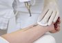 É possível remover tatuagem? Saiba como funciona o processo, seus riscos e cuidados