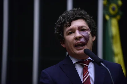 O deputado federal Reginaldo Lopes (PT-MG) é candidato à prefeitura de Belo Horizonte nas eleições de 2016.<!-- NICAID(12361143) -->