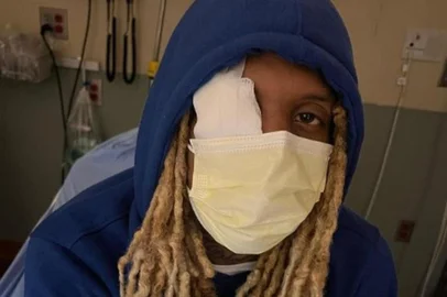 Rapper Lil Durk após ser atingido por fogos de artifício em show<!-- NICAID(15163456) -->