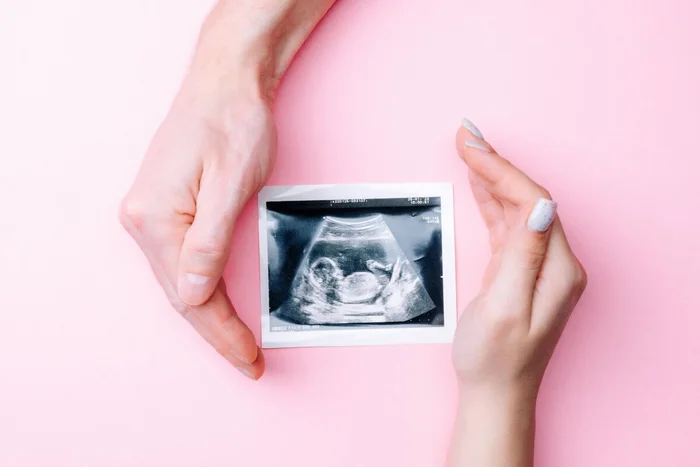 MVelishchuk / Shutterstock | Portal EdiCase MVelishchuk / Shutterstock | Portal EdiCase