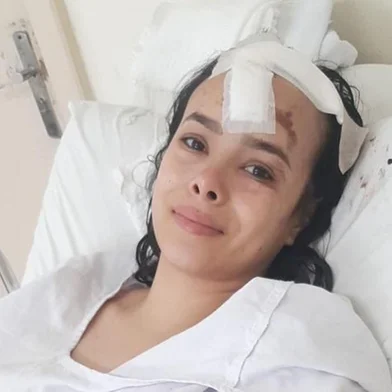 110 dias depois de ter a vida completamente transformada em razão de um acidente que resultou na morte da filha, Helena de Lima, de 4 meses, e do esposo, Adriano Batista de Lima, 50 anos,  Tainara Colombo, de 24 anos,  tenta reconstruir a vida.<!-- NICAID(15402735) -->