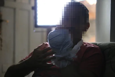 CANOAS.RS.BRASIL.2025,04,28.Vitima de seção de tortura, tortura praticada pelo dono de um loja de ferro velho, com choques elétricos, banho de água fervente,espacamentos e teve que amputar seu própio dedo.OBS:NÃO DEVE APARECER A CARA DA VITIMA.(RONALDO BERNARDI/AGENCIA RBS).<!-- NICAID(16005513) -->