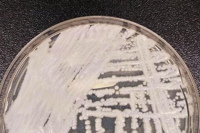 Centers For Disease Control and Prevention / Divulgação