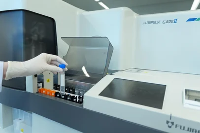 Divulgação / Hospital Moinhos de Vento Hospital de Porto Alegre é o primeiro do Brasil a disponibilizar exame de sangue para investigação de Alzheimer, com previsão de expansão para SUS ainda neste ano<!-- NICAID(16387913) -->
