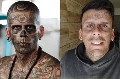 O homem que chegou a ser considerado o "mais tatuado do Brasil" publicou, nas redes sociais, os resultados da quarta sessão a laser para eliminar os desenhos no rosto.<!-- NICAID(16035720) -->