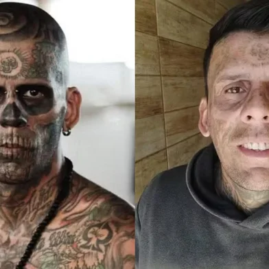 O homem que chegou a ser considerado o "mais tatuado do Brasil" publicou, nas redes sociais, os resultados da quarta sessão a laser para eliminar os desenhos no rosto.<!-- NICAID(16035720) -->