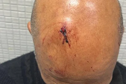 Homem de 59 anos é agredido após ser falsamente acusado de furto em supermercado de Porto Alegre<!-- NICAID(15847986) -->