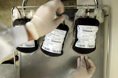 *** Lauro - Doaçao medula Hemocentro ***Doação de medula no Hemocentro<!-- NICAID(2066960) -->