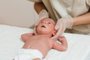 Fisioterapeuta alternando posição do bebê para corrigir um quadro de plagiocefalia, deformidade craniana que afeta recém-nascidos<!-- NICAID(15434777) -->