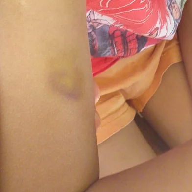 Polícia Civil investiga denuncia de lesão corporal contra menino autista em escolinha de Caxias<!-- NICAID(14939432) -->