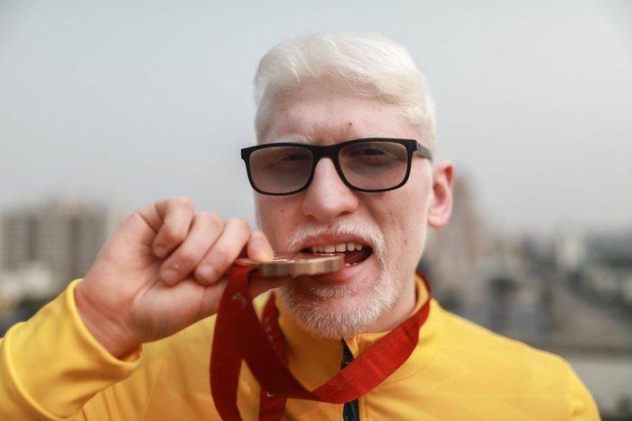 Renan Mattos / Agencia RBS