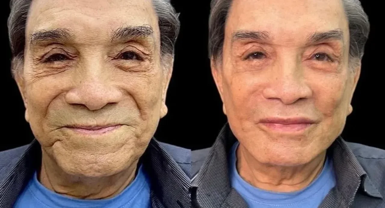 Reprodução
