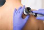 Câncer de pele exige prevenção o ano inteiro 