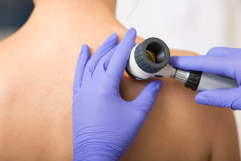dermatologist Inspecting patient skin moles at clinicDermatologista - Foto: Peakstock/stock.adobe.comIndexador: aFonte: 261942423<!-- NICAID(15349017) -->