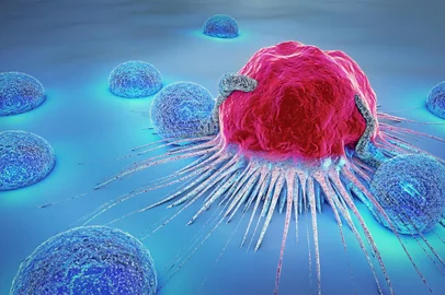 3d illustration of a cancer cell and lymphocytesFonte: 183722536<!-- NICAID(14394280) -->