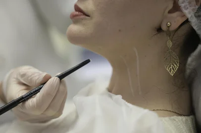 PORTO ALEGRE, RS, BRASIL, 06-07-2026: A Anvisa aprovou recentemente o uso de botox para tratamento no músculo platisma. Seria o primeiro tratamento estético aprovado para além da região do rosto. Vamos fazer uma matéria explicando se é possível aplicar botox no pescoço, o que significa a aprovação, em quais casos é possível utilizar, qual a frequência e como funciona o tratamento, e os riscos. Na foto: dermatologista Juliana Boza (Foto: André Ávila/Agência RBS)Indexador: Andre Avila<!-- NICAID(16321757) -->