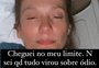Luisa Mell anuncia afastamento das redes sociais: "Cheguei no meu limite"