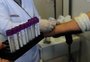 Registro de novos doadores de medula óssea no Brasil cai 25% em 2021; veja como ser voluntário