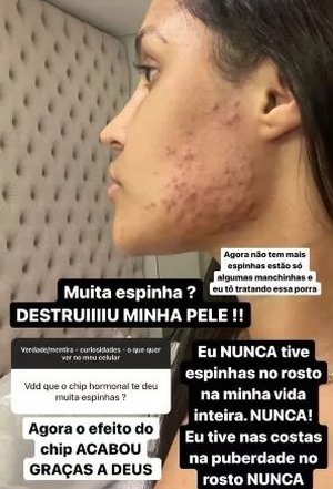 @flay Instagram / Reprodução