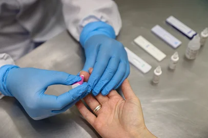 CAXIAS DO SUL, RS, BRASIL, 24/01/2025. Matéria sobre os índices de HIV em Caxias do Sul. Além dos dados, a reportagem também conheceu o que é oferecido para o diagnóstico e tratamento na rede pública de saúde. (Bruno Todeschini/Agência RBS)Indexador: Bruno Todeschini<!-- NICAID(15960829) -->