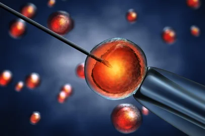 In Vitro fertilizationIntracytoplasmic sperm injection , sperm injected into an oocyte , detailed illustrationFonte: 52148296<!-- NICAID(15430129) -->