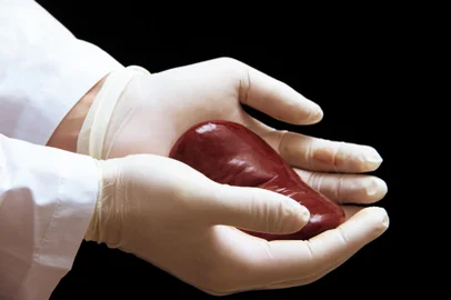 kidney transplant surgery concept. real kidney is in hands of transplant surgeon. cadaver, donor kidney. International Kidney Day Holiday.Tansplante de rim. Foto:  / stock.adobe.comFonte: 223197976<!-- NICAID(15873620) -->