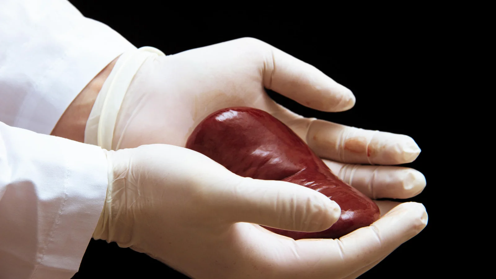 RS tem 1,3 mil pessoas na fila à espera de um rim | GZH