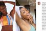 Erika Januza mostra resultado de tratamento para clarear axilas: "Me incomodava muito"