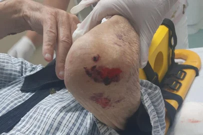TRAMANDAÍ, RS: Idoso de Imbé sofre agressões e é atendido no Hospital de Tramandaí. Filha dele é suspeita<!-- NICAID(15021695) -->