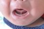 Tongue-tie patient , baby health problem , baby show tongue and gumFonte: 568484049<!-- NICAID(15404942) -->