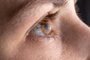 Macro eye photo. Keratoconus - eye disease, thinning of the cornea in the form of a cone. The cornea plastic*MICHELI AGUIAR* Macro eye photo. Keratoconus - eye disease, thinning of the cornea in the form of a cone. The cornea plastic. - Foto:  Zarina Lukash/stock.adobe.comFonte: 358548534<!-- NICAID(15143852) -->