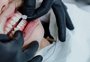 Conversas na cadeira do dentista