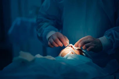 Cirurgião mexe no nariz de uma paciente. Rinoplastia.Fonte: 168862012<!-- NICAID(15991140) -->