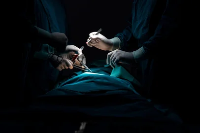 Surgical team performing surgery to patient in sterile operating room.Surgical team performing surgery to patient in sterile operating room. In a surgery room lit by a lamp, a professional and confident surgical team provides medical care to an unconscious patient.Fonte: 580086019<!-- NICAID(16361497) -->