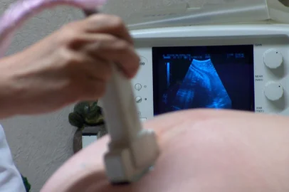 bebê, gravidez, gestante, ultrasom, mãe, sexo, exame, grávida<!-- NICAID(8139464) -->