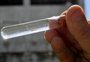 Governo vai enviar vacinas contra dengue para mais 29 municípios; nenhum no RS