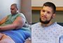 "Quilos Mortais": veja como está J.T., que pesava mais de 400 kg e tinha grave problema na perna