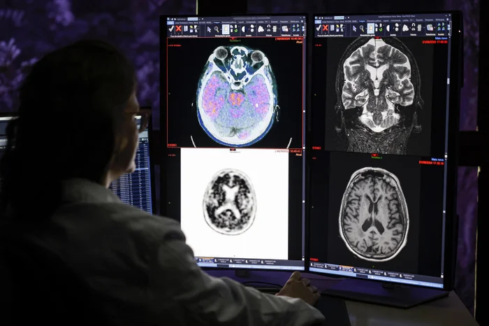 Mateus Bruxel / Agencia RBS