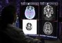 Quais os avanços e desafios na prevenção e no combate ao Alzheimer