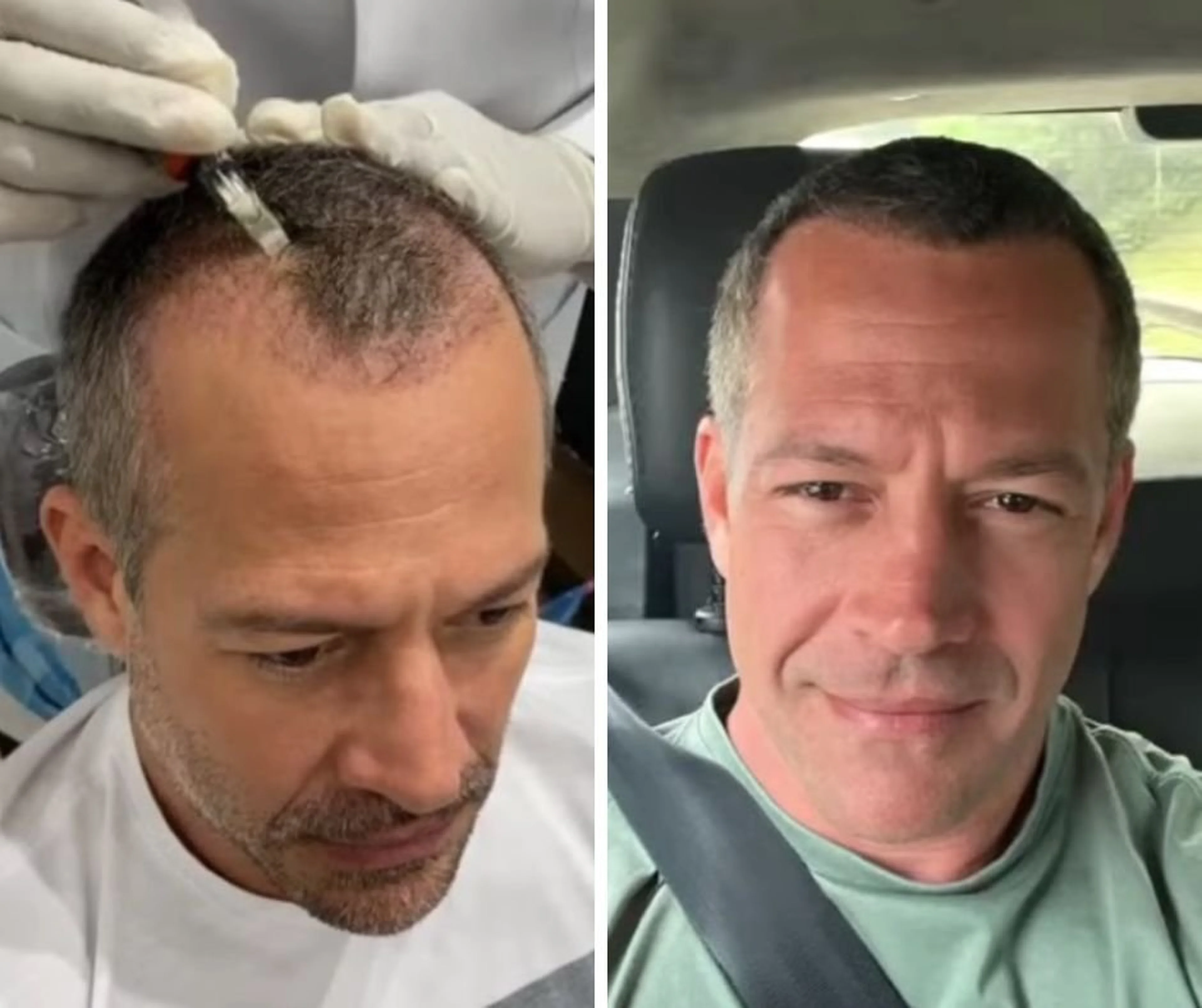 @eumalvinosalvador Instagram/Reprodução